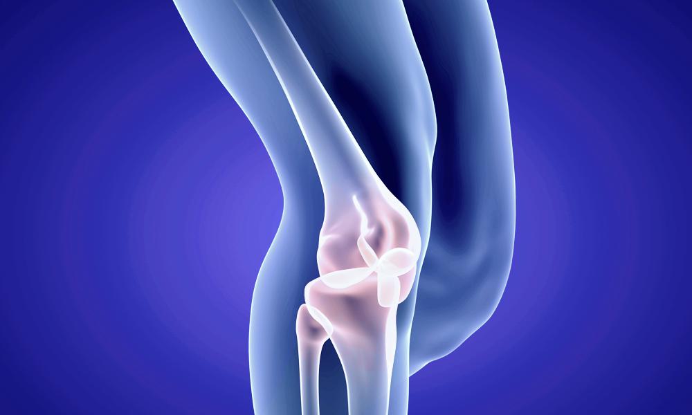 Chondroplasty - Knee cartilage replacement therapy