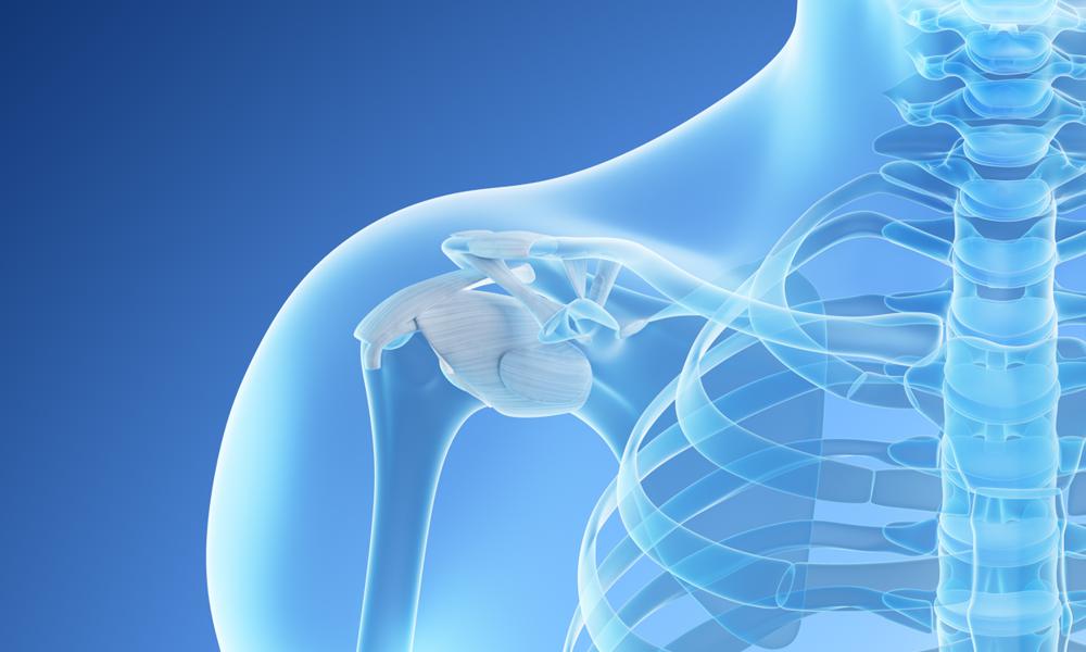 Total Shoulder Replacement for Osteoarthritis